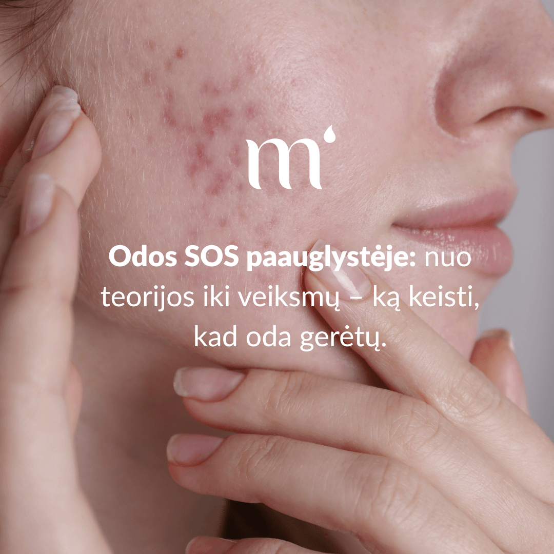 Odos SOS paauglystėje: nuo teorijos iki veiksmų – ką keisti, kad oda gerėtų