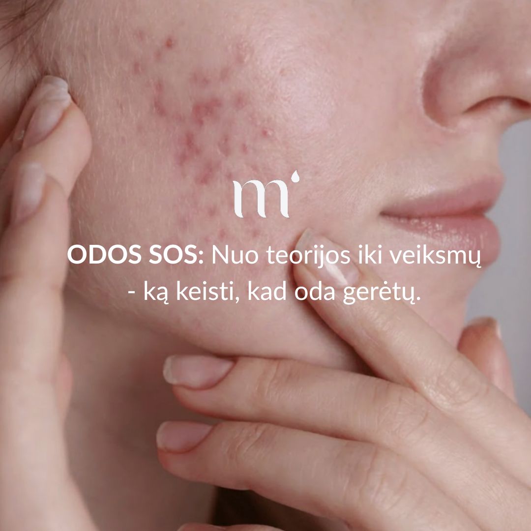 ODOS SOS: Nuo teorijos iki veiksmų - ką keisti, kad oda gerėtų